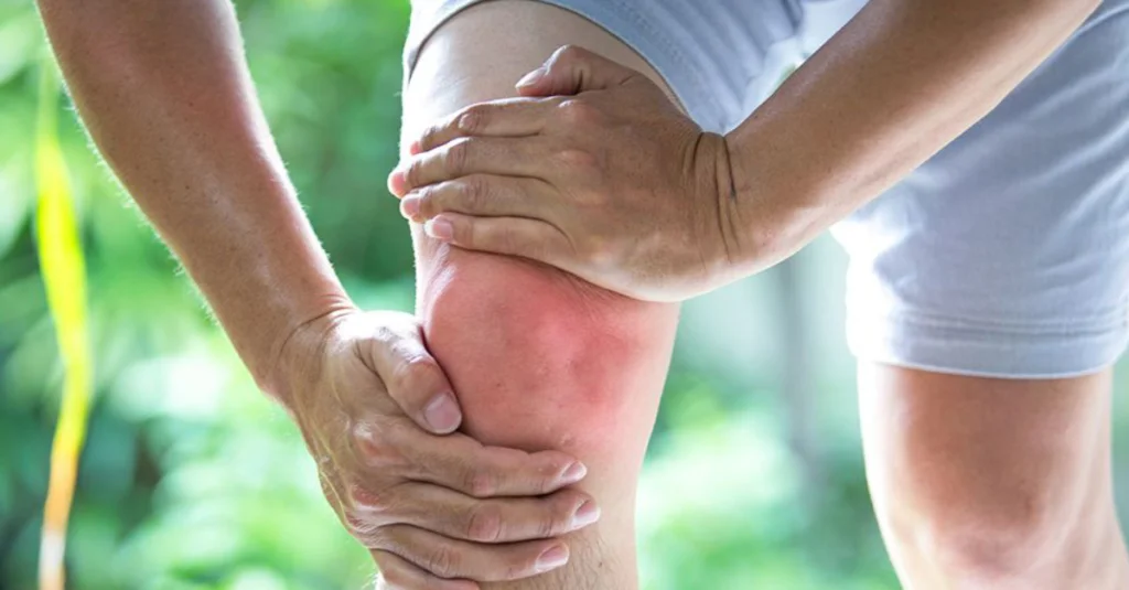 10 Tips Mengurangi Nyeri Sendi secara Alami